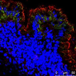 Rho-A proteins (red) in the intestinal epithelial cells (green) in the intestine of a patient with chronic inflammatory bowel disease (image: FAU/Rocío López Posadas)