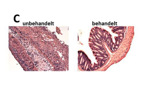 The untreated inflamed bowel wall (left) is full of immune cells (black dots) and has lost almost the entirety of its mucous membrane. The wall of the bowel treated with capsazepine (right) is normal and its mucous membrane is intact.