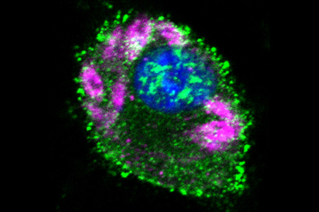 Zum Artikel "How tumour necrosis factor protects against infection"