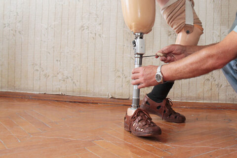 Zum Artikel "Printable prosthetics"